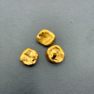 金歯　詰め物